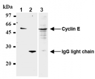 AM20286AF-N - Cyclin E1
