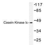 AP20419PU-N - Casein kinase I epsilon