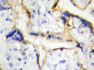 AP20419PU-N - Casein kinase I epsilon
