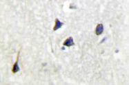 AP20397PU-N - Adenylate cyclase type 5