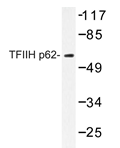 AP20413PU-N - GTF2H1 / BTF2