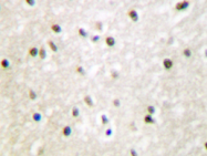 AP20413PU-N - GTF2H1 / BTF2