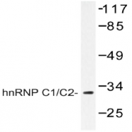 AP20405PU-N - hnRNP-C1/C2 / HNRNPC