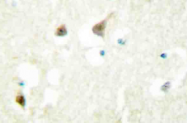 AP20405PU-N - hnRNP-C1/C2 / HNRNPC