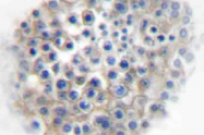 AP20407PU-N - Alpha-2A adrenergic receptor / ADRA2A