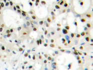 AP20408PU-N - hnRNP core protein A1 / HNRNPA1