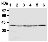 AM20292AF-N - HTRA2 / PRSS25