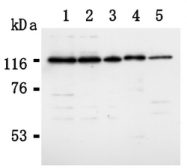 AM20294AF-N - RAD21