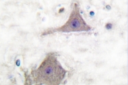 AP06142PU-N - mGluR7 / GRM7