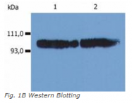 SM3103F - CD18 / ITGB2