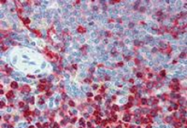 SM3103P - CD18 / ITGB2