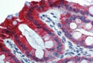 SM3043P - Cytokeratin 18