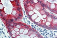 SM1360PS - Cytokeratin 18