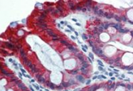 SM3043B - Cytokeratin 18