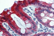 SM3043F - Cytokeratin 18