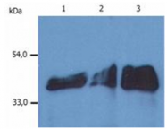 SM3044B - Cytokeratin 18