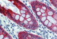 SM3044B - Cytokeratin 18