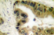 AP06156PU-N - HDAC10