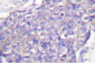 AP06445PU-N - CD40
