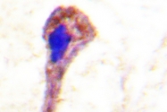 AP06571PU-N - PLCG2
