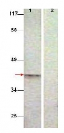 AP09251PU-N - Aurora kinase B