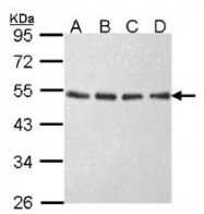AP22365PU-N - EIF2B / EIF2S2