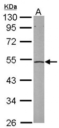 AP22365PU-N - EIF2B / EIF2S2