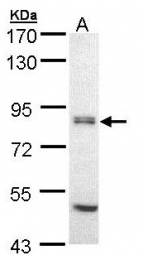 AP22366PU-N - EIF2B5 / EIF2BE