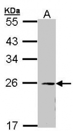 AP22368PU-N - EIF3K / EIF3S12