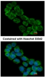 AP22367PU-N - EIF3A / EIF3S10