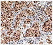 SP2058P - Aurora kinase A