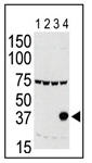 AP13519PU-N - Aurora kinase C