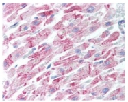 AP09220PU-N - Amyloid beta