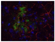 AP09220PU-N - Amyloid beta