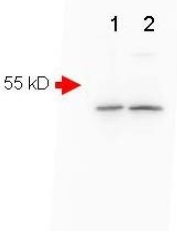 AP09220PU-N - Amyloid beta