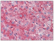 R1035P - Apolipoprotein C III / ApoC3