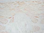 BM4103B - BMP6