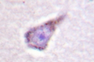 AP06593PU-N - WAS / IMD2