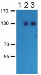 AP03015PU-N - GABBR2