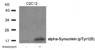 AP09463PU-N - Alpha-Synuclein / SNCA