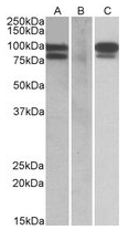 AP22407PU-N - PCSK9
