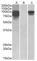 AP22408PU-N - PCSK9