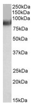AP22452PU-N - TRIM55 / MURF2 / RNF29