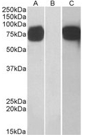 AP22450PU-N - Golgi membrane protein 1 / GOLM1