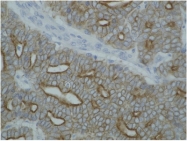 BM555S - pan Cytokeratin
