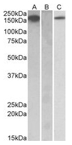 AP22414PU-N - CD115