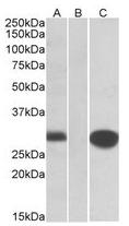 AP22415PU-N - Mid1-interacting protein 1