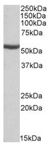 AP22423PU-N - ALDH6A1 / MMSDH