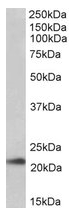 AP22430PU-N - TMEM205