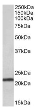 AP22431PU-N - TMEM205